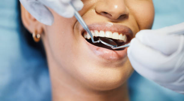 Best Urgent Tooth Repair  in Telluride, CO